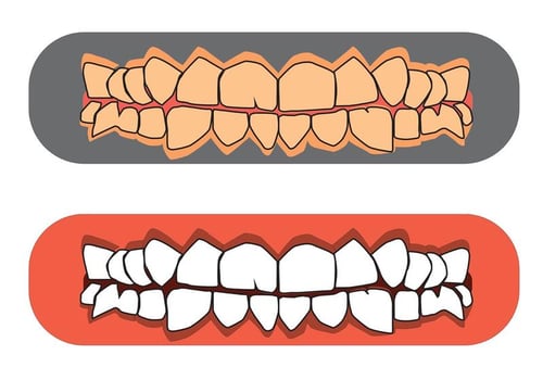 Free Teeth and Gums Vectors 