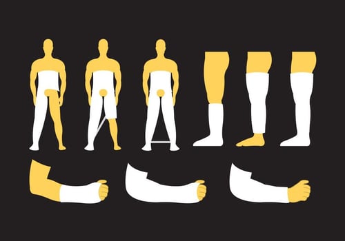 Broken Limb Vectors