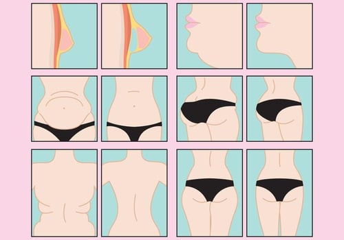 Before And After Treatments vector