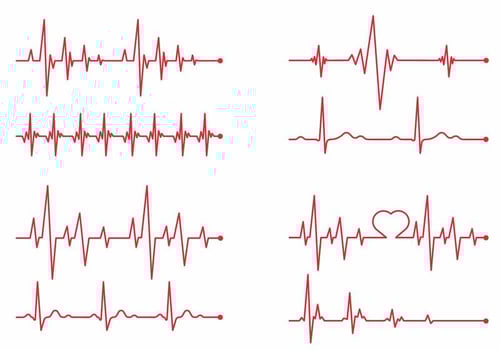 Heart Monitor Vector Set