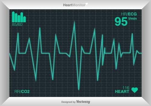 Vector Cardiogram Of Heart