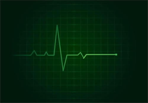 Flatline Background Free Vector