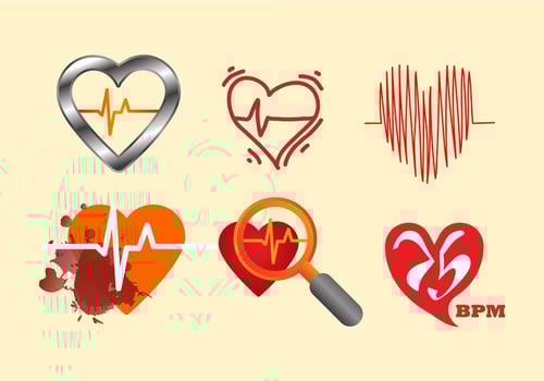 Free Heart Rate Vector Illustration