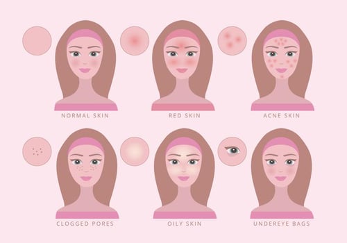 Vector Skin Conditions Illustration