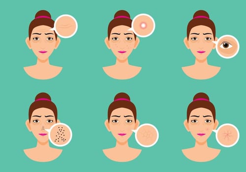 Women Skin Problem vector