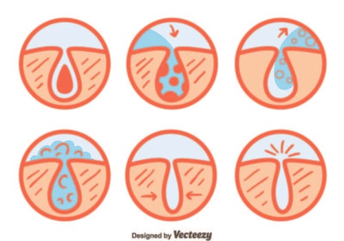 Pimple Vector Set