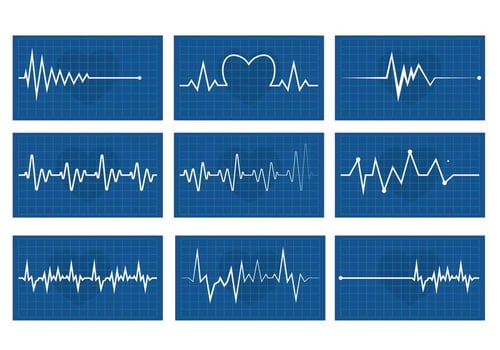 Heart rhythm vector set