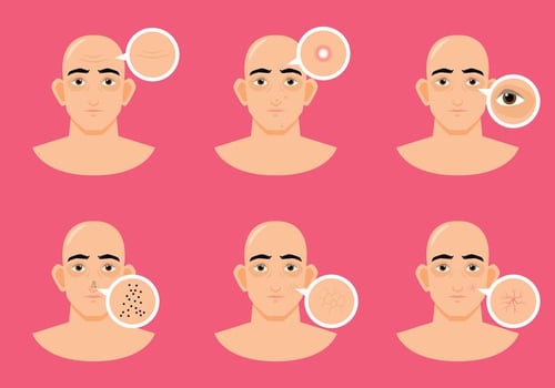 Man Skin Problem vector