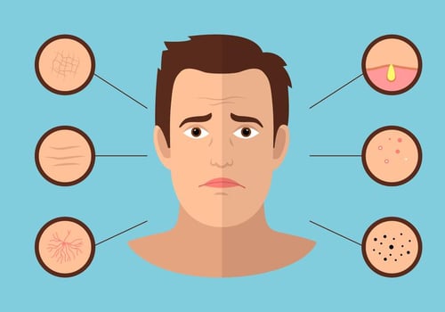 Mans Face Problem vector