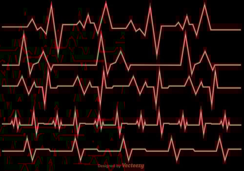 Vector Illustration Heart Rhythm Ekg Vector