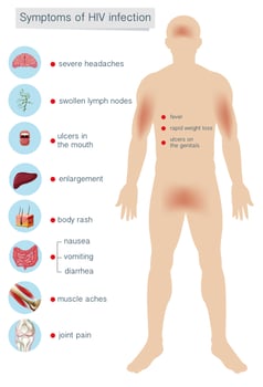 Human Anatomy Symptoms of HIV Infection vector