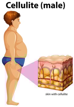 A fat man with cellulite vector