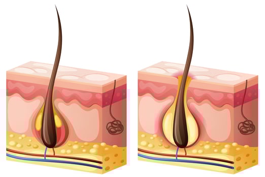 Diagram showing hair growing from skin vector