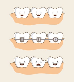 Set of cartoon dental teeth images vector