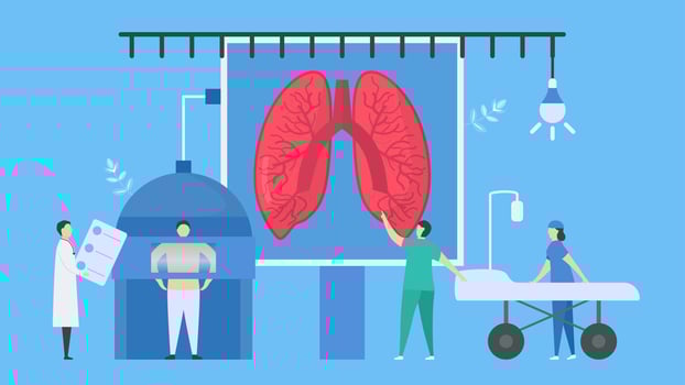 Medical scanning to check the x-ray of lungs vector