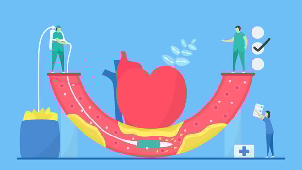 Atherosclerosis Concept with Staff Cleaning Artery vector