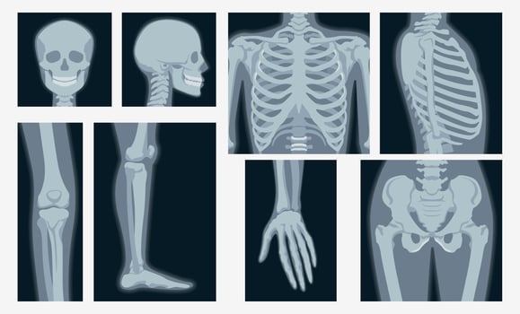 Different x-rays shot of human body part set vector