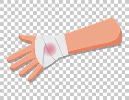 Injury arms with gauze on transparent background vector
