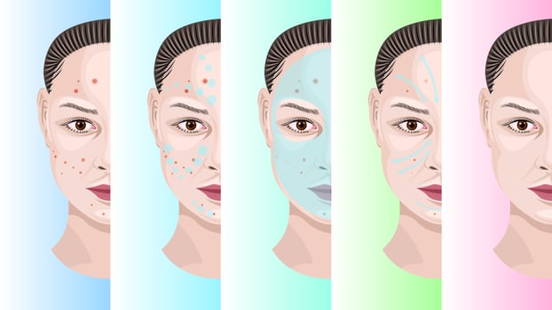 Woman Face Step by Step Acne Treatment vector