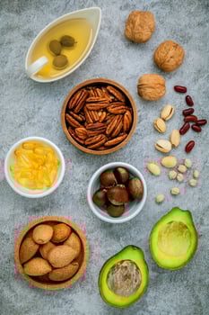 Top view of healthy foods on a gray background photo