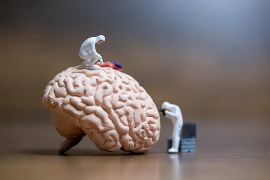Miniature people of scientists observing the human brain, medical healthcare and surgical doctor service concept photo
