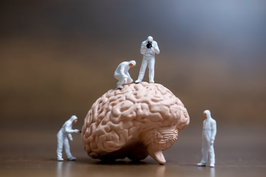 Miniature scientists observing and discussing the human brain, medical healthcare and surgical doctor service concept photo