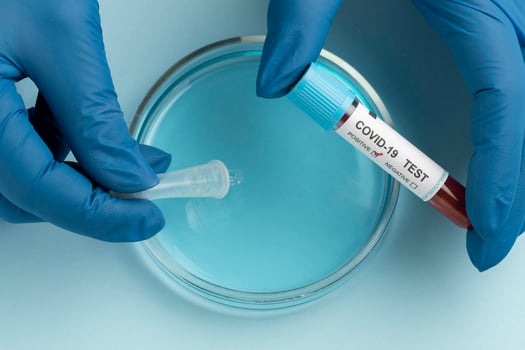 Hand with protective gloves analyzing a covid test with a petri dish photo