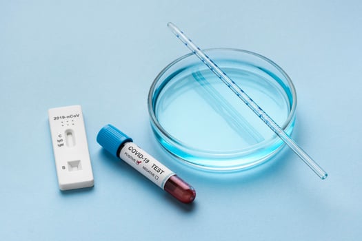Petri dish and blood sample for covid test photo