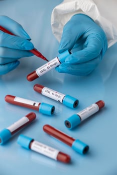 Hand with protective gloves holding a blood samples for covid test photo