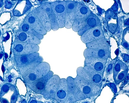 Kidney Collecting duct photo