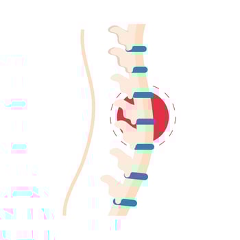 rheumatism vertebral column vector