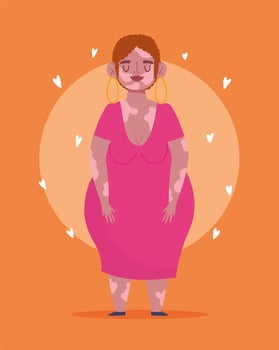 perfectly imperfect, plus size cartoon woman with vitiligo vector