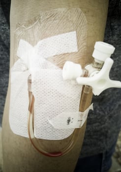 Person with Intravenously photo