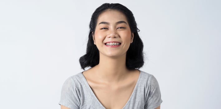 Dental braces of teen asian woman wearing braces teeth and contact lenses photo
