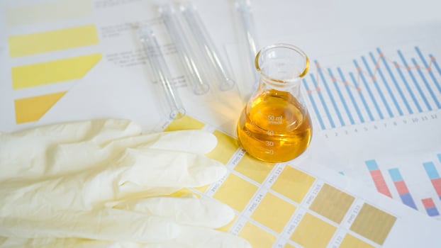 Urine test. Flask with analyzes on medical tables photo