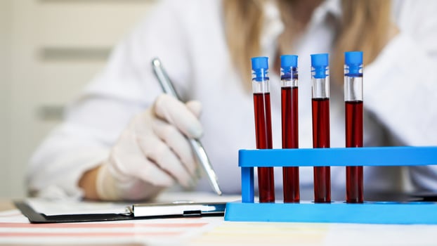 Woman working with blood samples in laboratory, closeup photo