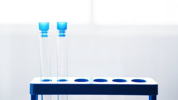 Test tubes on a blue stand on blurred gray background photo