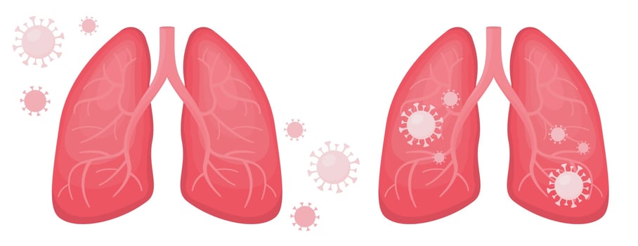 Human lungs infected and healthy coronavirus covid vector