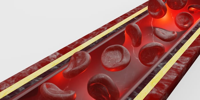 red blood cells skin layer veins 3d illustration intravascular surgery photo
