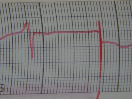 Scientific charts, cardiograms and mathematical calculations photo