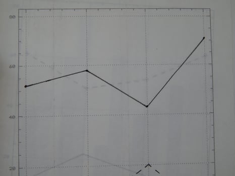 Scientific charts, cardiograms and mathematical calculations photo