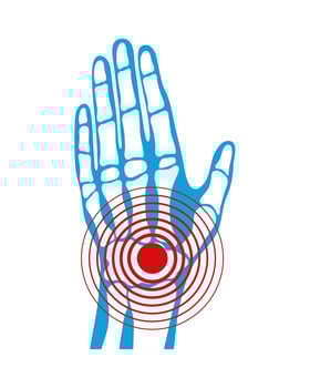tunel carpal rheumatological pain vector