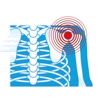 shoulder rheumatological pain vector