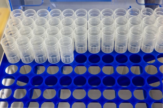 Tips in blue plastic rack for micropipette photo