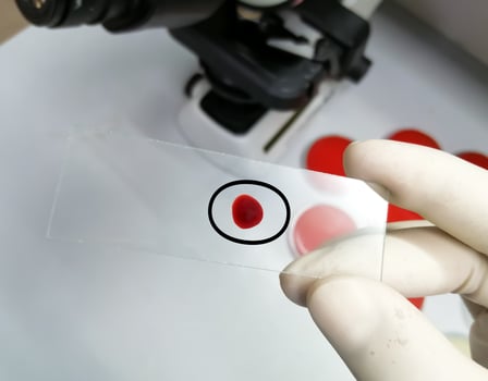 Hand of scientist hold glass slide with a drop of blood for further laboratorical testing. photo