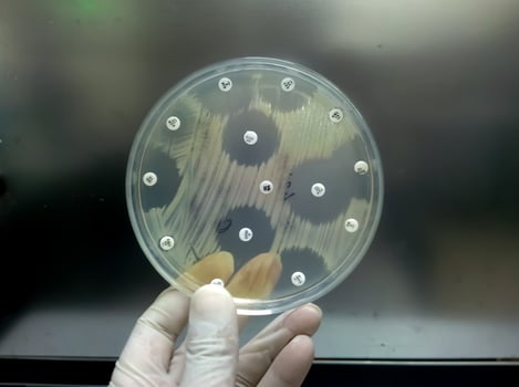 Antimicrobial susceptibility testing in petri dish. Antibiotic resistance of bacteria photo