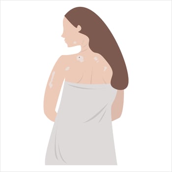 A woman with vitiligo. A woman in a towel vector