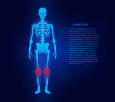 Pain of the knee joints concept. Blue background and red injury man body leg medicine template. Painful Joints. Rheumatism or rheumatic disorder medical. vector