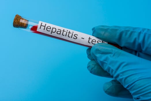 Hepatitis test, Blood in the test Tube. photo
