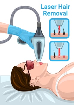Laser Hair Removal Face Woman Cartoon vector